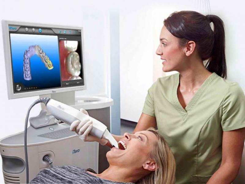 Scanned Impression for Molding at Thomson Dental Laboratory in Tyler, TX